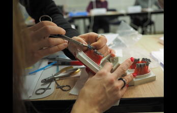 Ортодонтія - Лікування 2/2 класу без видалення