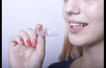 Ортодонтія - Елайнери в практиці  стоматолога. Використання системи прозорих кап .