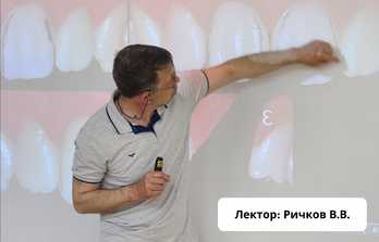 Терапия - Простой способ достижения «невидимых» реставраций: инновации в воспроизведении цвета фронтальных зубов (Выставка Дентал Украина 2025 - Львов)